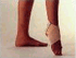 Sprains & Strains