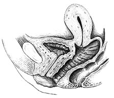 Uterus